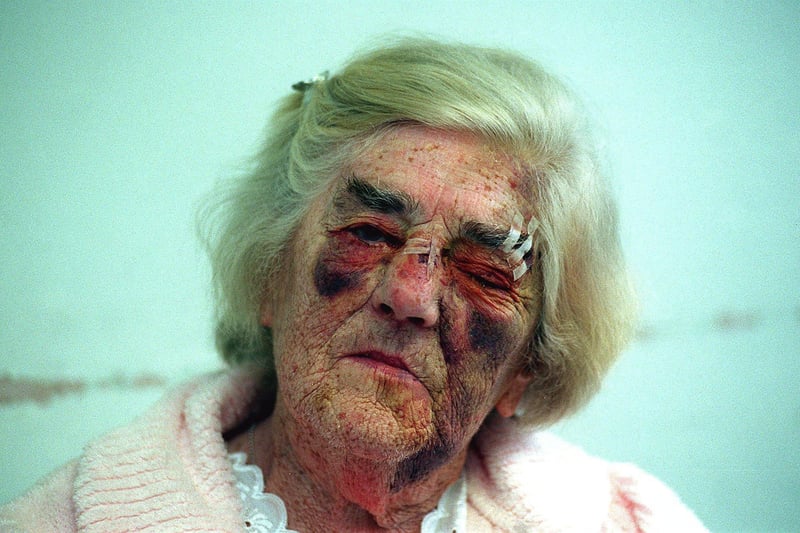 This is 81-year-old Mary Hansborough who was recovering after being attacked at her home in Gipton in September 1999.