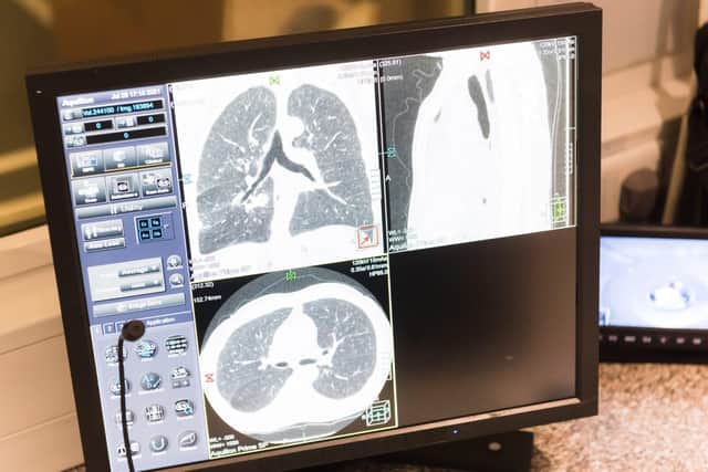 Combined lung and kidney scan