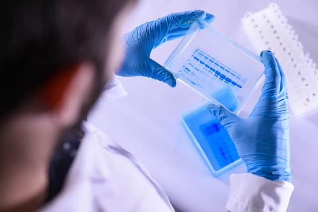 Large-scale trials of the treatment have started in the UK (Getty Images)