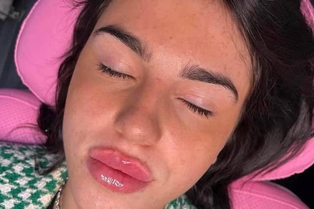 She paid £100 to have it injected in her mum's living room - and soon became obsessed with her looks. Picture: Maisie-Jane Southwell / SWNS