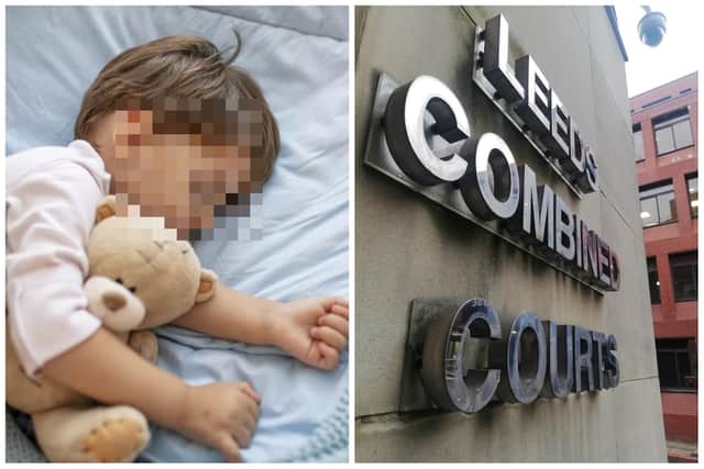The parents were both jailed at Leeds Crown Court for inflicting or allowing a catalogue of serious injuries on the youngster.