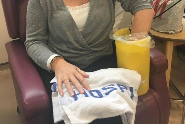 Sam Panter, 48, during her first treatment for anal cancer.