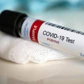 Key workers and their families in England are now eligible for coronavirus testing (Photo: Shutterstock)