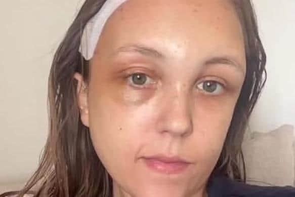 Becca Taylor, a 26-year-old mum and teacher, had her life turned upside down after going to hospital with persistent headaches, only to be diagnosed with stage 4 astrocytoma brain cancer.