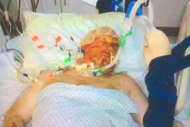 This picture was taken shortly after Paul was injured in the terrorist attack. Picture: Day One Trauma Support.