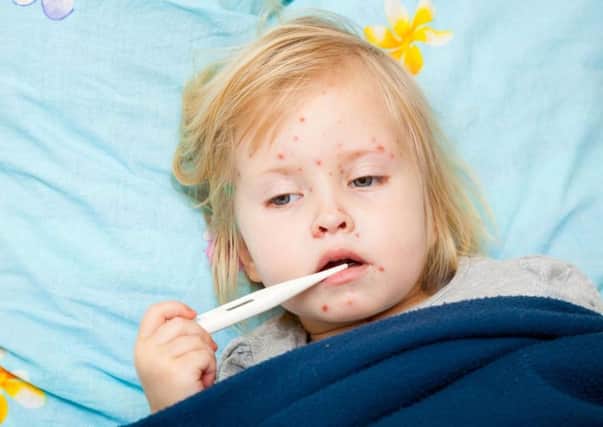 Measles.  PA Photo/thinkstockphotos