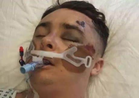 Hundreds of people have paid tribute to a Leeds teenager after his family shared a harrowing image of him to warn others of the dangers of drug use.