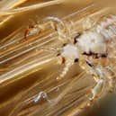 Head lice treatment will no longer be available on prescription