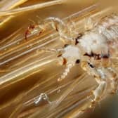 Head lice treatment will no longer be available on prescription