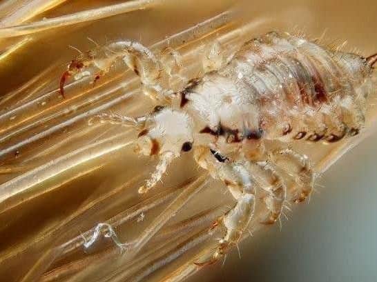 Head lice treatment will no longer be available on prescription