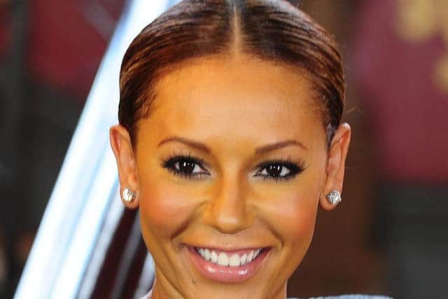 Mel B has suffered injuries including two broken ribs in an accident