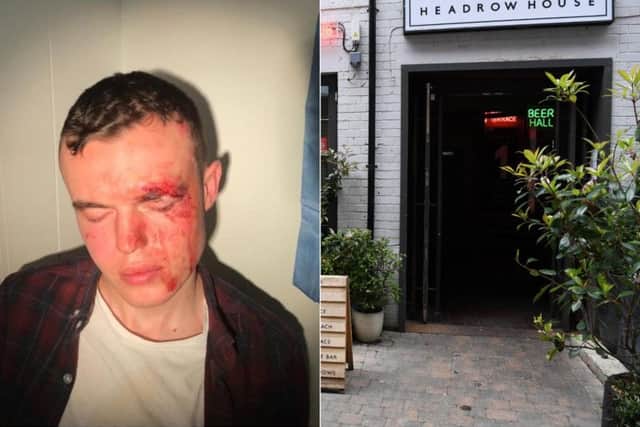 George Black was beaten up at the bar and police are investigating