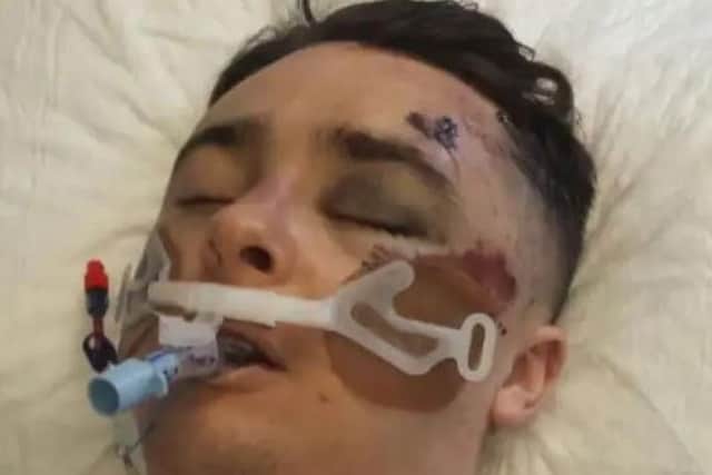Josh Edwards pictured in St James Hospital.