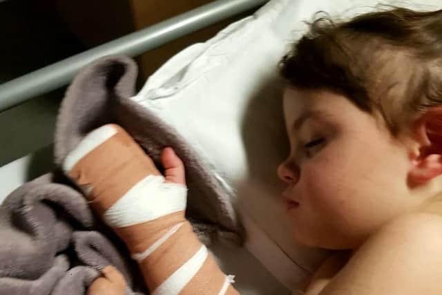 These horrific pictures show the third-degree burns suffered by a two-year-old girl after she tried to rescue her twin's teddy bear from catching fire. PICS: SWNS
