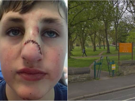 The teenager was set upon in Cross Flatts Park, Beeston.