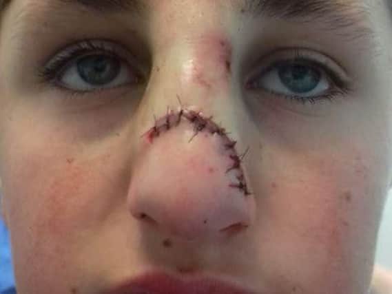Casey Murthick was attacked in Cross Flatts Park, Beeston.