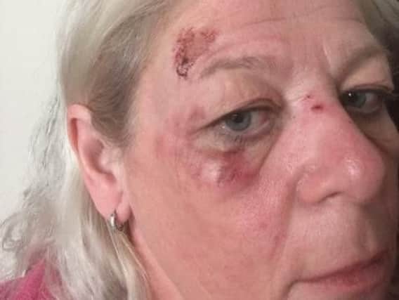 Yvette Talbot was attacked on her way home from work last night.