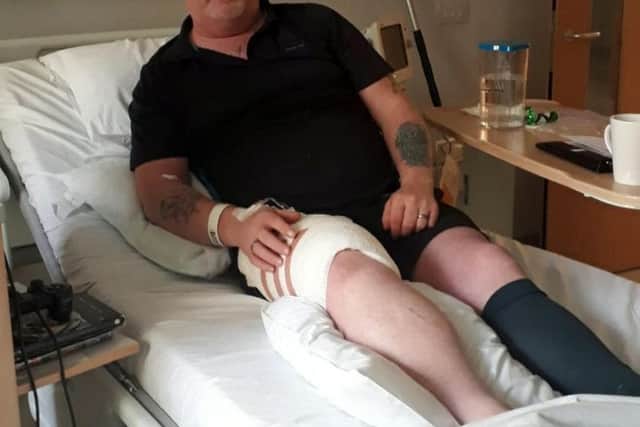 Bob Allsopp, who was injured when his e-cigarette exploded. Photos: SWNS