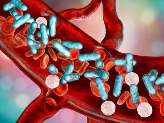 Sepsis is a serious condition that can be fatal if it isnt spotted and treated quickly.