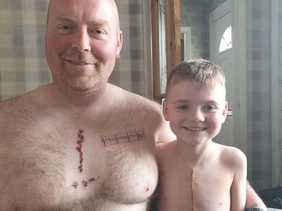 Martin Watts and son Joey. Martin has had Joey's scar from open heart surgery tattooed on his chest to show him he can be proud of the scar.