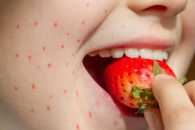 One in four people with food allergies taken ill while dining out