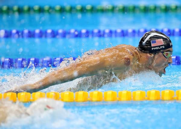 Evidence of cupping can be seenon American swimmer Michael Phelps's arm.  Mike Egerton/PA Wire.