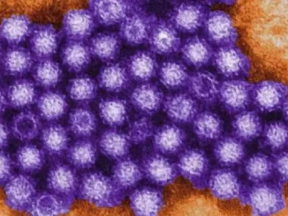 Norovirus can quickly spread at this time of year.