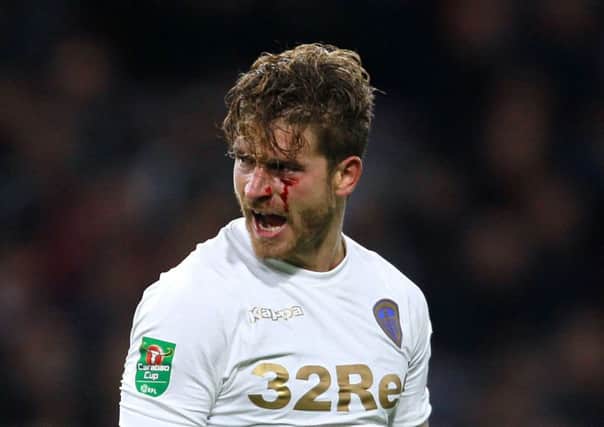 Leeds United's Gaetano Berardi with a cut on his eye at Turf Moor on Tuesday night. Picture: Richard Sellers/PA