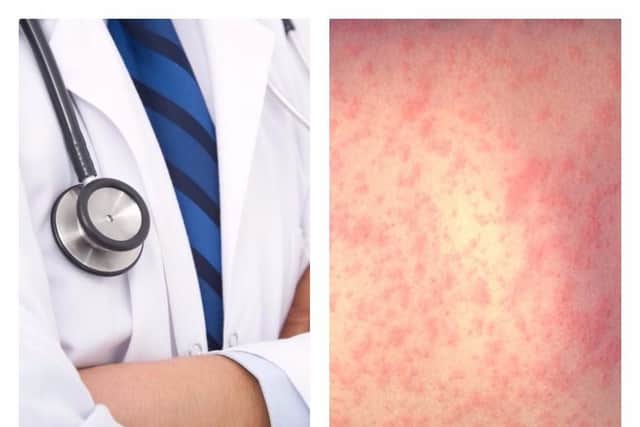 Follow the NHS guidelines to spot the signs of measles.
