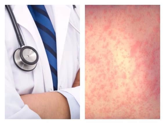 Follow the NHS guidelines to spot the signs of measles.