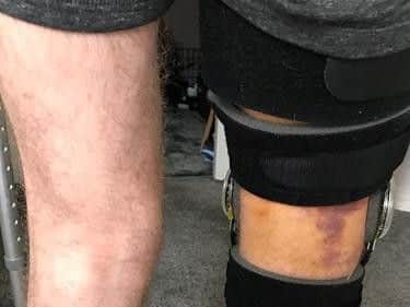 X-rated tackle means footballer 'may never play again'