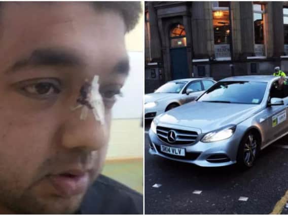 Leeds taxi driver Awais Hussain was badly injured by a yob throwing stones last summer.
