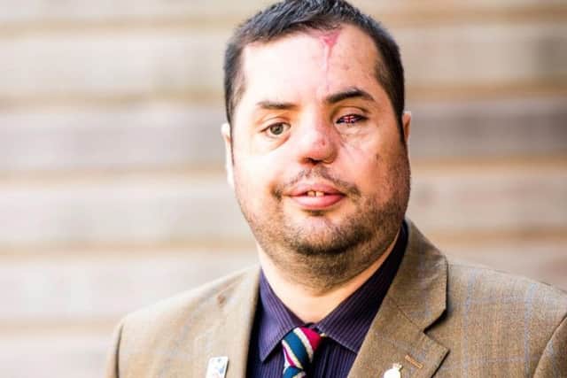 Simon Brown, from Morley, Leeds.