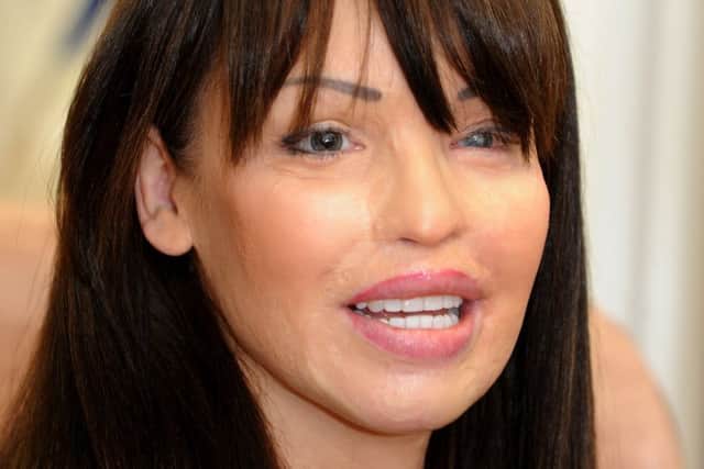 TOUR: Katie Piper will appear at the City Varieties.