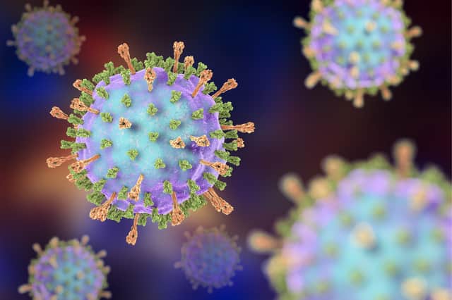 Mumps is a contagious viral infection, which used to be common in children before the MMR vaccine was introduced (Photo: Shutterstock)