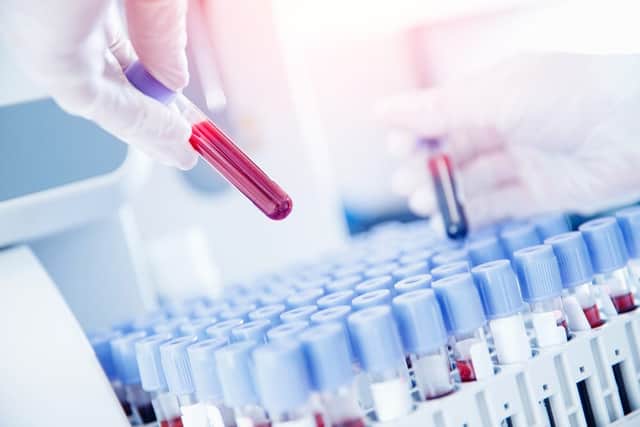 The React-2 study showed that almost 90 per cent of people over the age of 80 tested positive for antibodies after two doses of the Pfizer-BioNTech vaccine (Photo: Shutterstock)